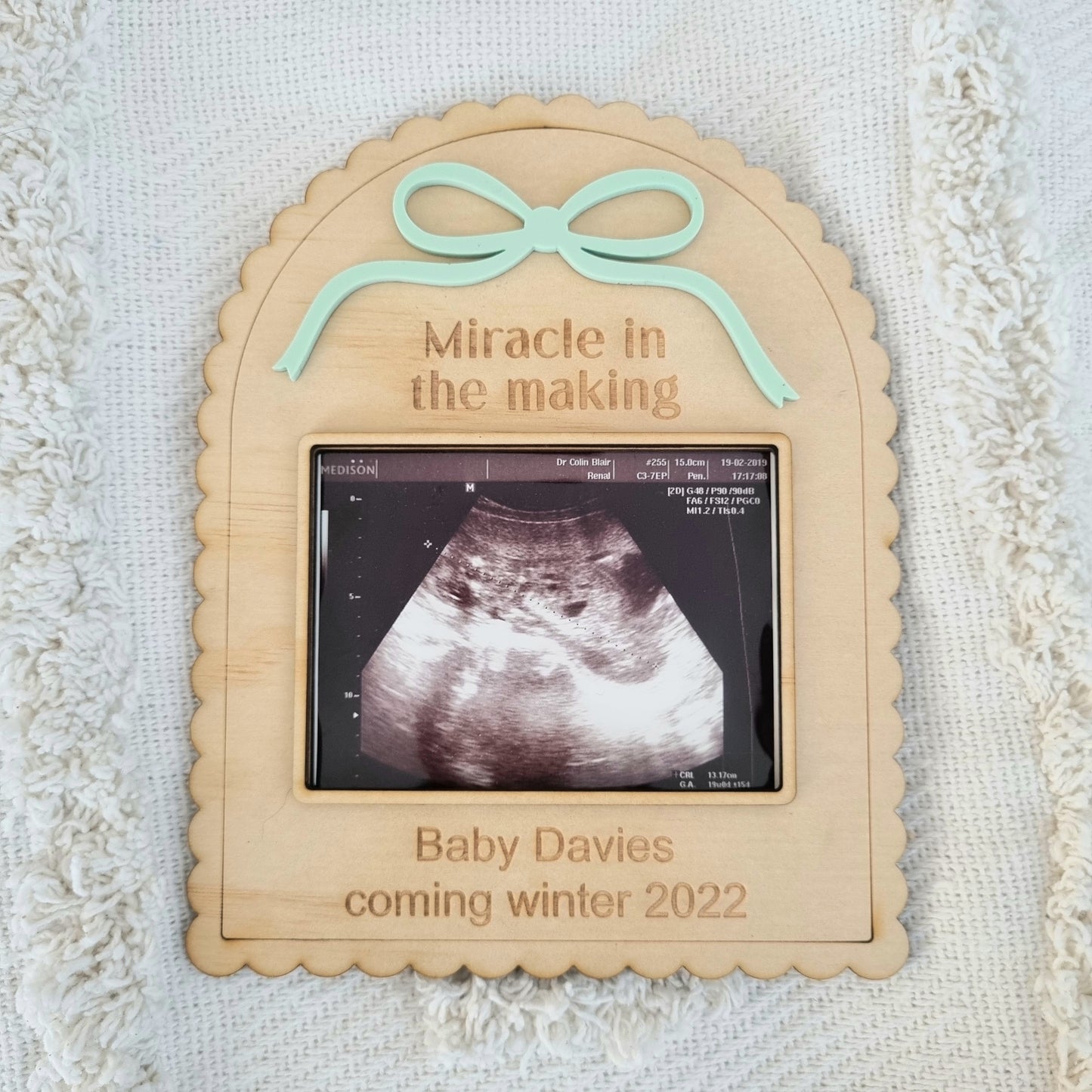 Ultrasound Photo Frame